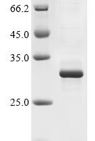 Mouse Metalloproteinase inhibitor 3 (Timp3) Recombinant Protein - BioCrest Sci