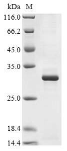 Mouse Metalloproteinase inhibitor 3 (Timp3) Recombinant Protein, Mus musculus (Mouse), E.coli, N-terminal 10xHis-tagged and C-terminal Myc-tagged, 29.1 kDa, purity >≥ 85% as determined by SDS-PAGE.