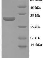 Human Metallothionein-1E (MT1E), partial Recombinant Protein - BioCrest Sci