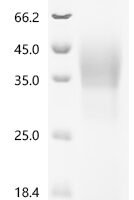 Human LIM/homeobox protein Lhx3 (LHX3) Recombinant Protein - BioCrest Sci