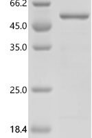 Human RB1-inducible coiled-coil protein 1 (RB1CC1), partial Recombinant Protein, C-His, aa 1241–1594 - BioCrest Sci