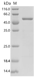 Human RB1-inducible coiled-coil protein 1 (RB1CC1), partial Recombinant Protein, C-His, aa 1241–1594, Homo sapiens (Human), E.coli, C-terminal 6xHis-tagged, 47.6 kDa, purity >≥ 85% as determined by SDS-PAGE.