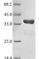 Human CREB-binding protein (CREBBP), partial Recombinant Protein - BioCrest Sci