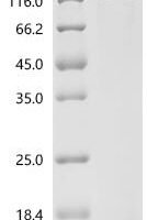 Human Origin recognition complex subunit 1 (ORC1) Recombinant Protein, C-His, aa 1–861, E.coli - BioCrest Sci