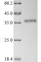 Human Heterogeneous nuclear ribonucleoproteins A2/B1 (HNRNPA2B1) Recombinant Protein, C-His, aa 1–249 - BioCrest Sci