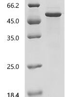 Human Pyruvate dehydrogenase E1 component subunit alpha, somatic form, mitochondrial (PDHA1), partial Recombinant Protein, C-His - BioCrest Sci