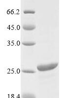 Helicobacter pylori Bacterial non-heme ferritin (ftnA) Recombinant Protein, N-10His, aa 1–167, Yeast - BioCrest Sci
