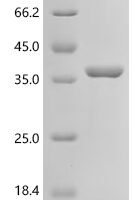 Mycobacterium bovis Diacylglycerol acyltransferase/mycolyltransferase Ag85B (fbpB) Recombinant Protein, N-10His/C-Myc - BioCrest Sci