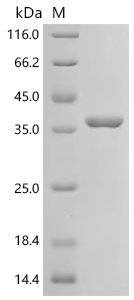Mycobacterium bovis Diacylglycerol acyltransferase/mycolyltransferase Ag85B (fbpB) Recombinant Protein, N-10His/C-Myc, Mycobacterium bovis (strain BCG / Pasteur 1173P2), E.coli, N-terminal 10xHis-tagged and C-terminal Myc-tagged, 38.1 kDa, purity >≥ 95% as determined by SDS-PAGE.