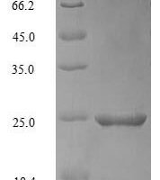Mouse Apolipoprotein C-III (Apoc3) Recombinant Protein - BioCrest Sci