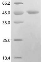 Cat Beta-2-microglobulin (B2M) Recombinant Protein, C-hFc1 - BioCrest Sci