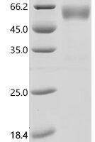 Human NKG2-D type II integral membrane protein (KLRK1), partial Recombinant Protein - BioCrest Sci