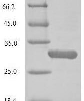 Human Oxytocin-neurophysin 1 (OXT) Recombinant Protein, N-His-SUMOstar - BioCrest Sci