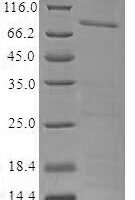Human Centromere protein F (CENPF), partial Recombinant Protein - BioCrest Sci