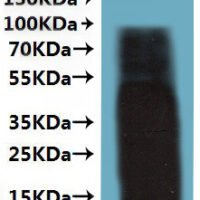 Rat Transmembrane 4 L six family member 1 (Tm4sf1)-VLPs Recombinant Protein - BioCrest Sci