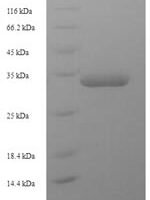 Escherichia coli Universal stress protein F (uspF) Recombinant Protein - BioCrest Sci