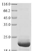 Pig Fatty acid-binding protein, heart (FABP3) Recombinant Protein - BioCrest Sci