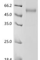 Human Natural killer cells antigen CD94 (KLRD1), partial Recombinant Protein - BioCrest Sci