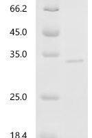 Pig Tenascin (TNC), partial Recombinant Protein, C-His, aa 1520–1735, E.coli - BioCrest Sci