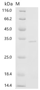 Pig Tenascin (TNC), partial Recombinant Protein, C-His, aa 1520–1735, E.coli, Sus scrofa (Pig), E.coli, C-terminal 6xHis-tagged, 31.7 kDa, purity >≥ 90% as determined by SDS-PAGE.