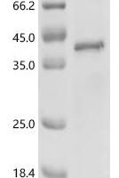 Human Ribonuclease H1 (RNASEH1) (D210N) Recombinant Protein - BioCrest Sci