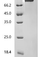 Mouse Agrin (Agrn), partial Recombinant Protein - BioCrest Sci