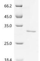 Escherichia coli Transposon Tn3 resolvase (tnpR) Recombinant Protein - BioCrest Sci