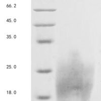 Human Homeobox protein Hox-A2 (HOXA2), partial Recombinant Protein - BioCrest Sci