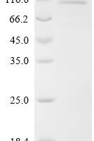 Human Cold shock domain-containing protein E1 (CSDE1) Recombinant Protein, N-10His/C-Myc - BioCrest Sci
