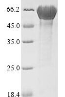 Escherichia coli O157:H7 flagellin (fliC) Recombinant Protein - BioCrest Sci