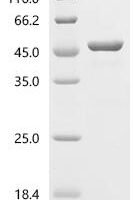 Neisseria gonorrhoeae Probable peptidoglycan D,D-transpeptidase PenA (penA), partial Recombinant Protein - BioCrest Sci