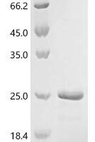 Mouse Galectin-9 (Lgals9), partial Recombinant Protein - BioCrest Sci