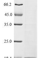 Human NAD (+) hydrolase SARM1 (SARM1), partial Recombinant Protein, N-10His - BioCrest Sci