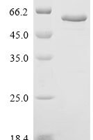 Human Copper-transporting ATPase 2 (ATP7B), partial Recombinant Protein - BioCrest Sci