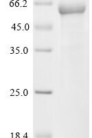 Human Formimidoyltransferase-cyclodeaminase (FTCD) Recombinant Protein, N-10His - BioCrest Sci