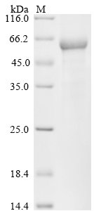 Human Formimidoyltransferase-cyclodeaminase (FTCD) Recombinant Protein, N-10His, Homo sapiens (Human), E.coli, N-terminal 10xHis-tagged, 65.0 kDa, purity >≥ 85% as determined by SDS-PAGE.