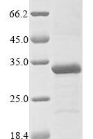 Human Three prime repair exonuclease 1 (TREX1), partial Recombinant Protein - BioCrest Sci