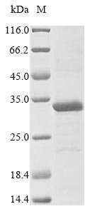 Human Three prime repair exonuclease 1 (TREX1), partial Recombinant Protein, Homo sapiens (Human), E.coli, N-terminal 10xHis-tagged and C-terminal Myc-tagged, 32.7 kDa, purity >≥ 85% as determined by SDS-PAGE.