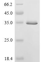 Arabidopsis thaliana Probable WRKY transcription factor 51 (WRKY51) Recombinant Protein - BioCrest Sci