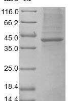 Human Heat-stable enterotoxin receptor (GUCY2C), partial Recombinant Protein - BioCrest Sci