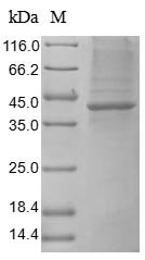 Human Heat-stable enterotoxin receptor (GUCY2C), partial Recombinant Protein, Homo sapiens (Human), Baculovirus, N-terminal 10xHis-tagged, 48.5 kDa, purity >≥ 85% as determined by SDS-PAGE.