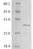 Human Collagen alpha-1(XI) chain (COL11A1), partial Recombinant Protein - BioCrest Sci