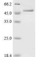 Human Ubiquitin thioesterase otulin (OTULIN) Recombinant Protein - BioCrest Sci