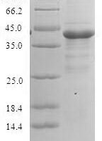 Human Peptidyl-prolyl cis-trans isomerase A-like 4A/B/C (PPIAL4A) Recombinant Protein - BioCrest Sci