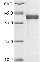 Mouse Acrosin  (ACR) Recombinant Protein - BioCrest Sci