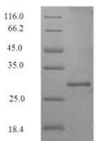 Staphylococcus aureus ATP-dependent Clp protease ATP-binding subunit ClpC (clpC), partial Recombinant Protein - BioCrest Sci