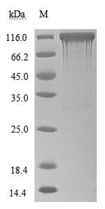 Recombinant Human Angiotensin-converting enzyme 2 (ACE2), partial (Active)