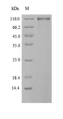 Recombinant Human Angiotensin-converting enzyme 2 (ACE2), partial, Biotinylated (Active)