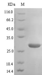 Recombinant Human Atypical chemokine receptor 3 (ACKR3), partial, Homo sapiens (Human), E.coli, N-terminal 6xHis-SUMO-tagged, 20.5kDa, purity >90% as determined by SDS-PAGE.