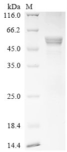 Recombinant Human Cis-aconitate decarboxylase (ACOD1), Homo sapiens (Human), E.coli, N-terminal 10xHis-tagged, 58.7kDa, purity >90% as determined by SDS-PAGE.